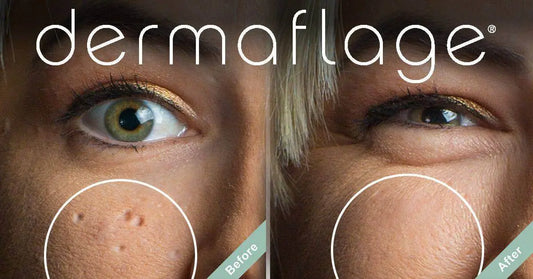 Dermaflage Fills the Scars that ScarAway Silicone Sheets Can't.