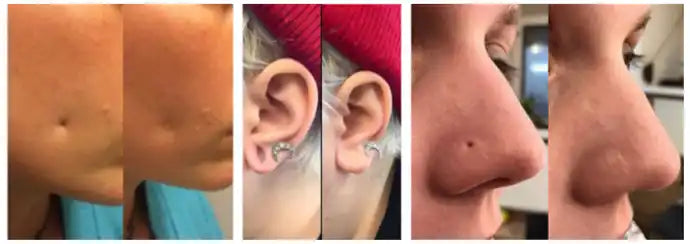 how to fill in a piercing