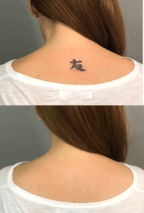 How to Cover A Tattoo