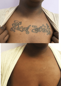 Tattoo Cover Up 213x300 1 2
