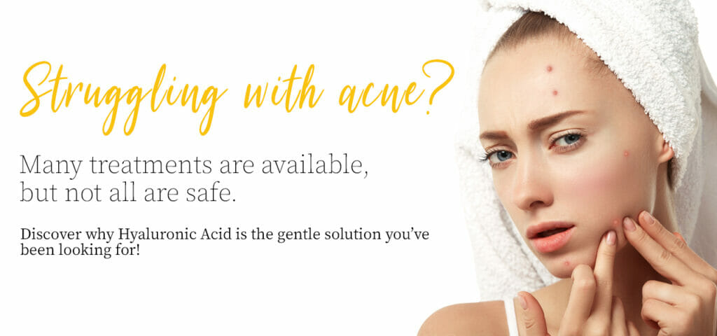 Struggling with acne?Many treatments are available, but not all are safe.Discover why Hyaluronic Acid is the gentle solution you’ve been looking for!
