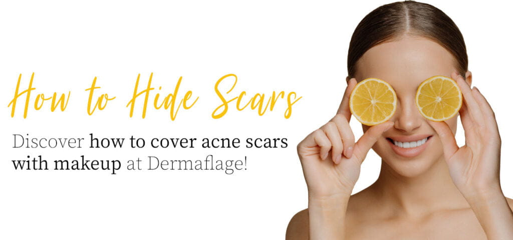 How To Hide Scars 1024x480